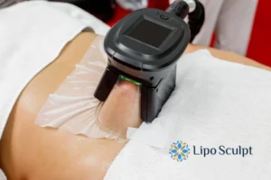 Cryolipolysis Helping You Getting that Perfect Summer Body 3 Cryolipolysis Wallingford can give you the best summer body - contact us today!